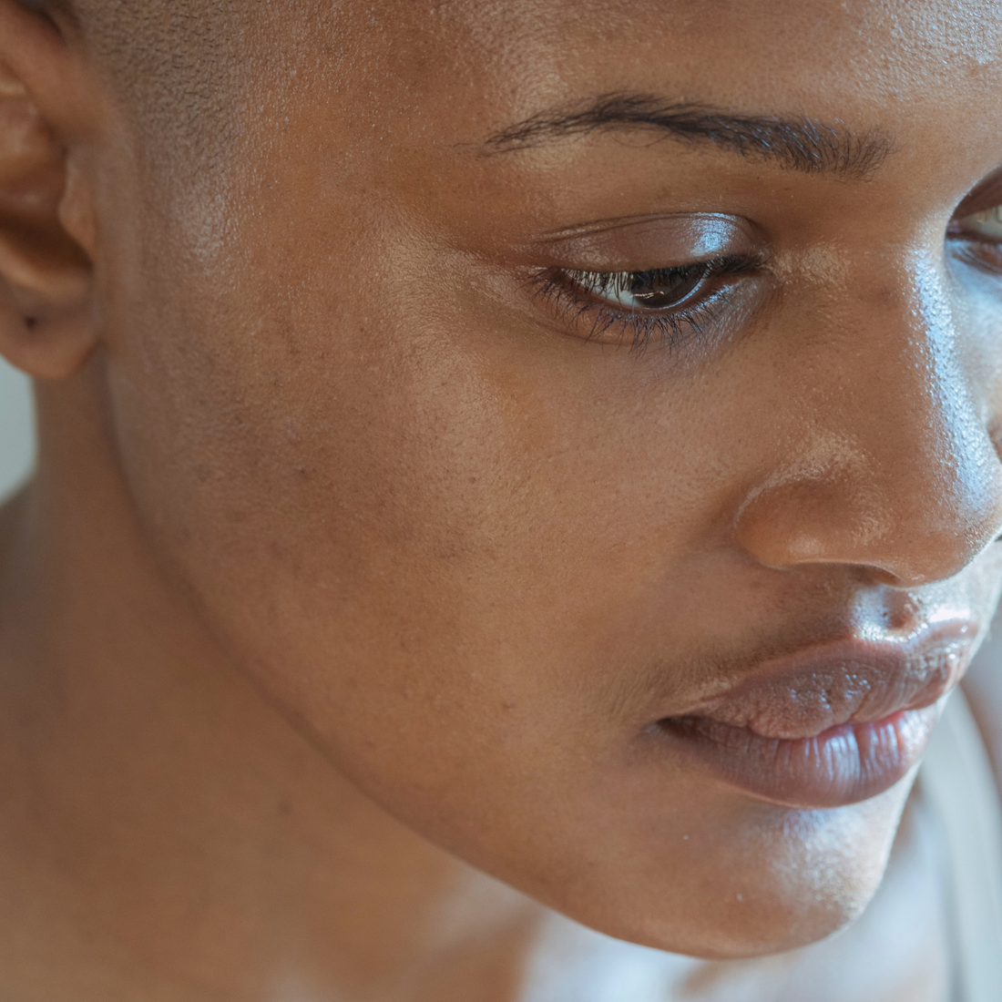 kire skin pielęgnacja skóry trądzikowej. Widoczne pory 